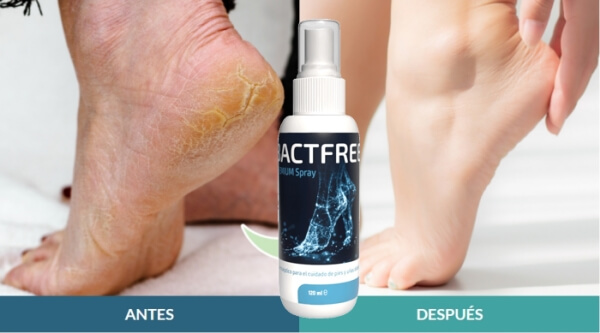 Bactfree spray cream Reviews Dominican Republic - Opinions, price, effects