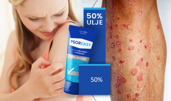 Psoreasy cream Reviews Albania Kosovo - Opinions, price, effects