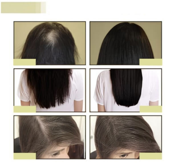EELHOE Hair Growth Oil – What Is It & How Does It Work