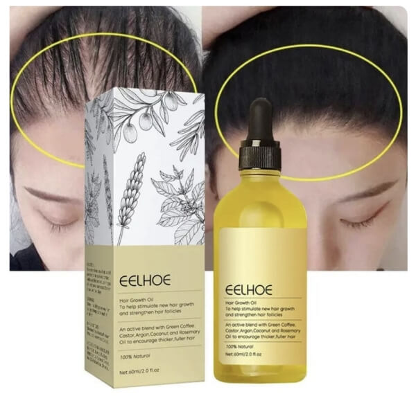 EELHOE Hair Growth Oil Price in Europe – Where to Buy